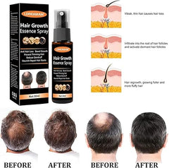 Hair Regrowth Spray